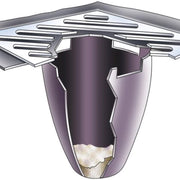 Ultra-Drain Guard